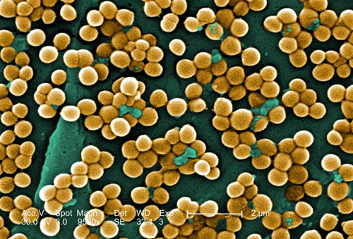 MRSA: Methicillin-resistant Staphylococcus aureus infections, e.g., bloodstream, pneumonia, bone infections…: Human-Animal Medicine states: "The risk of transmission between humans and other animals may vary by species and type of MRSA. One study found evidence of MRSA transmission between dogs and veterinary workers. Equine-human zoonotic transmission has been clearly established. The mode of transmission in the community is thought to be primarily by hands that have become contaminated by contact with colonized or infected body sites of other individuals or fomites contaminated with body fluids containing MRSA. Other factors contributing to transmission include skin-to-skin contact, crowded conditions, and poor hygiene. Risk factors for acquisition of MRSA are likely to include certain antimicrobial use in veterinary medicine.  This 2005 scanning electron micrograph (SEM) depicted numerous clumps of methicillin-resistant Staphylococcus aureus bacteria, commonly referred to by the acronym, MRSA; Magnified 9560x. Image from Centers for Disease Control and Prevention Public Health Image Library, Atlanta, GA). Image by CDC/ Janice Haney Carr/ Jeff Hageman, M.H.S.
